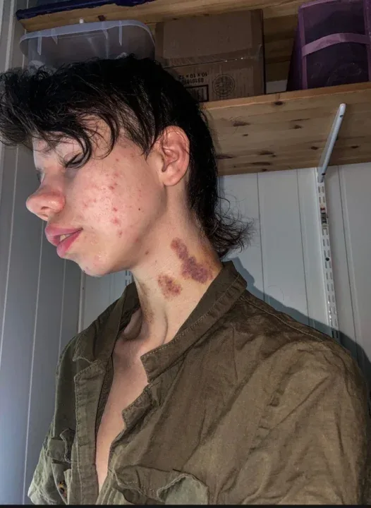 Norske Onlyfans Rancid